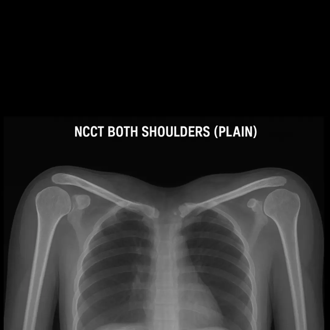 NCCT BOTH SHOULDERS (PLAIN)