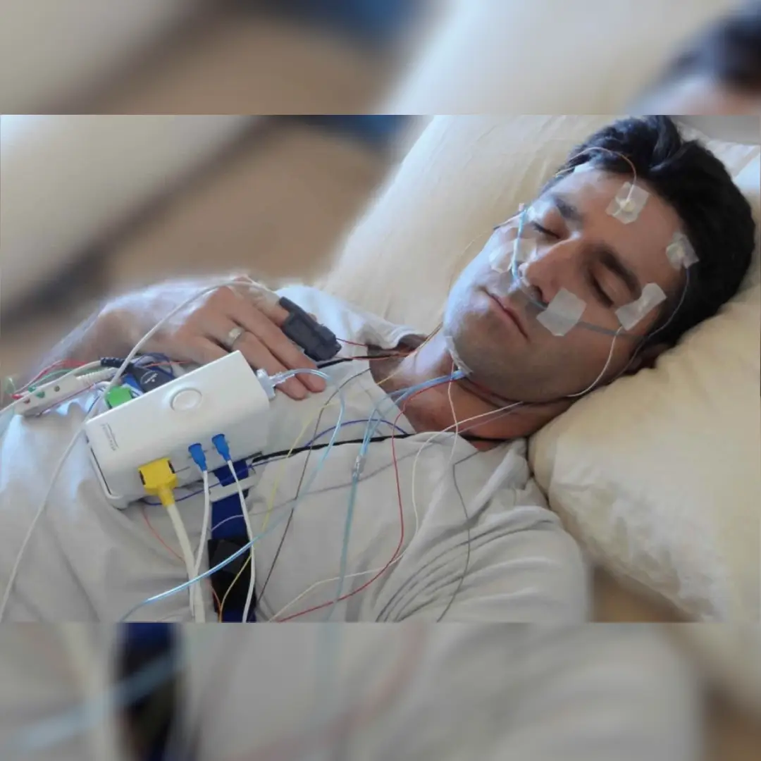 PSG – POLYSOMNOGRAPHY (SLEEP STUDY)