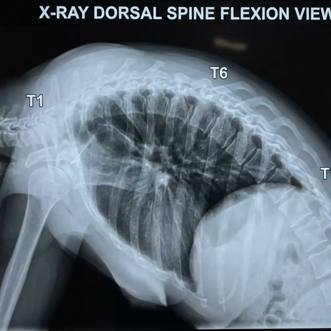 X-RAY DORSAL SPINE FLEXION VIEW