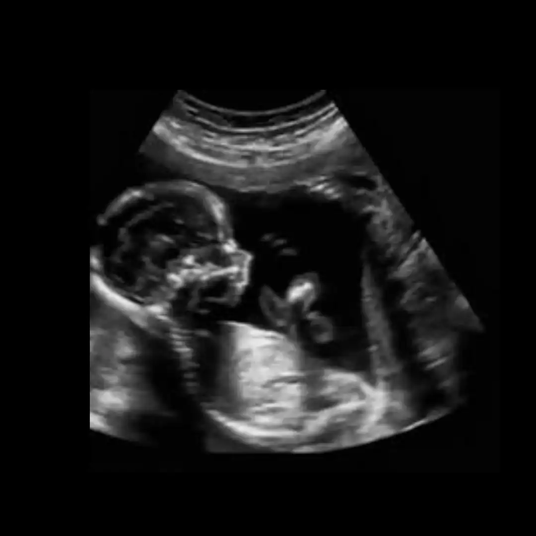 USG GROWTH WITH BIOPHYSICAL STUDY